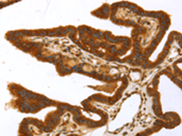 TP53I11 Antibody