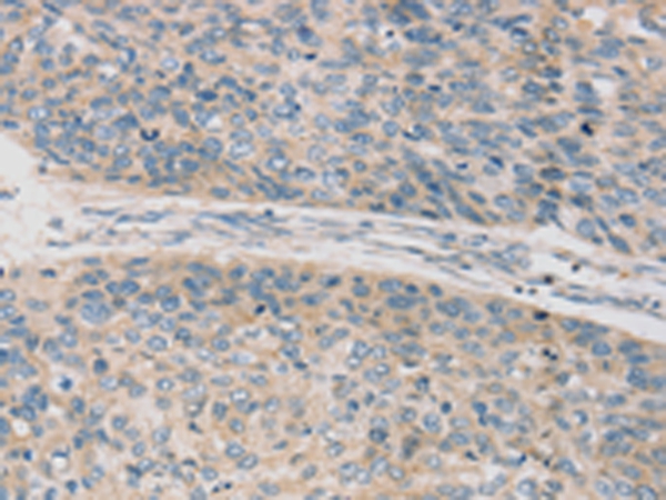 TPH2 Antibody