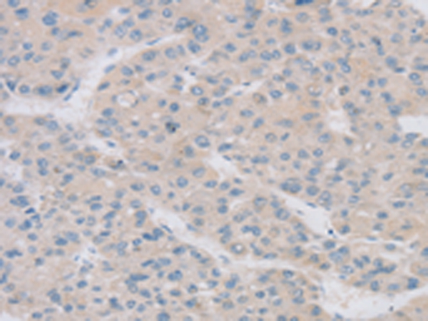 TPH2 Antibody