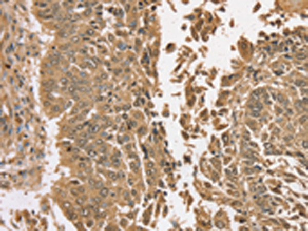 TGM6 Antibody