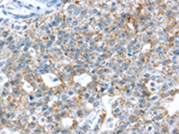 TTBK1 Antibody