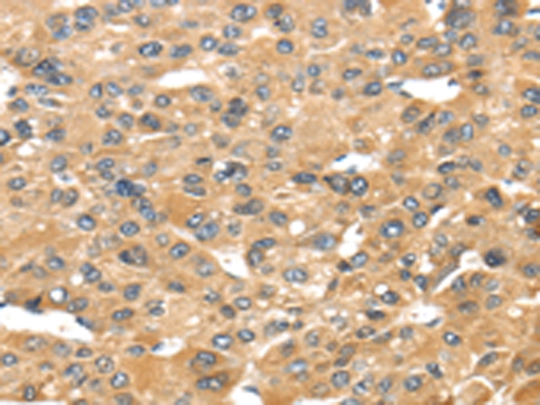 UCP1 Antibody