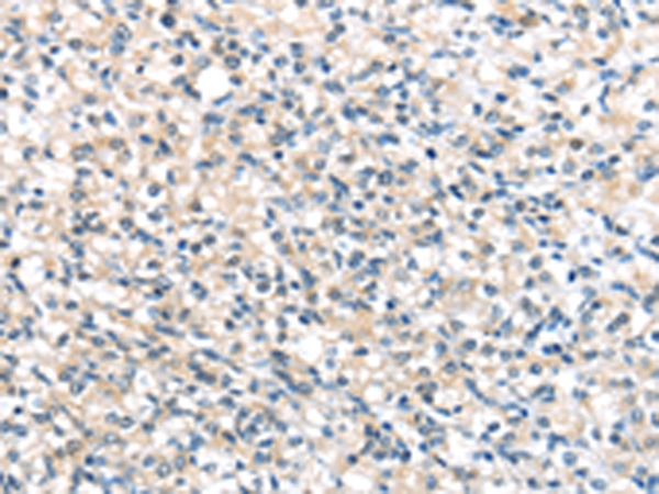 UCP3 Antibody