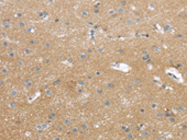 WASF2 Antibody