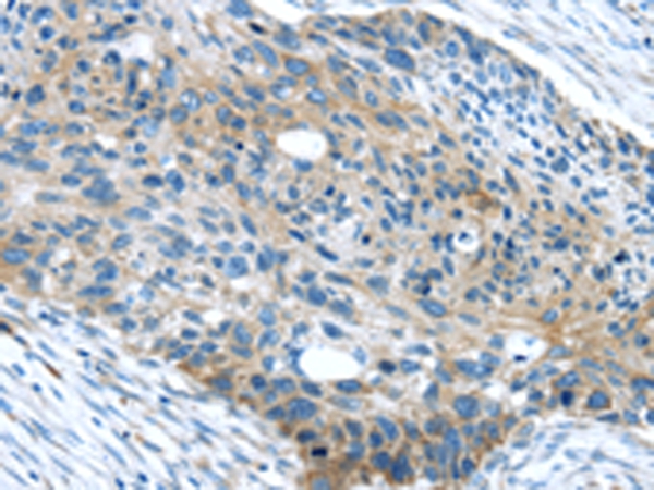 WASF2 Antibody