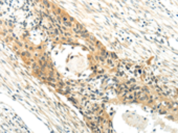 XK  Antibody