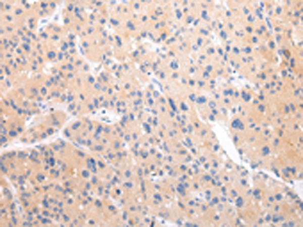 ZNF106 Antibody