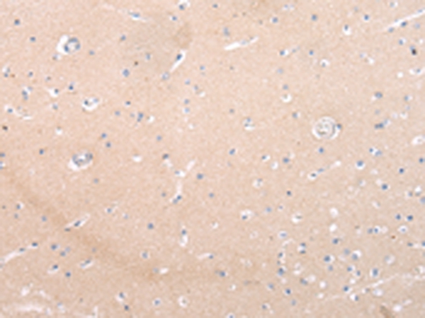 ZNF106 Antibody