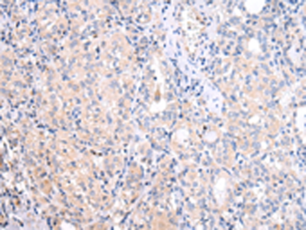 ATF6 Antibody