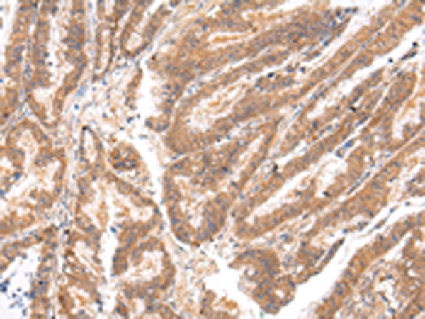 ATP7B  Antibody
