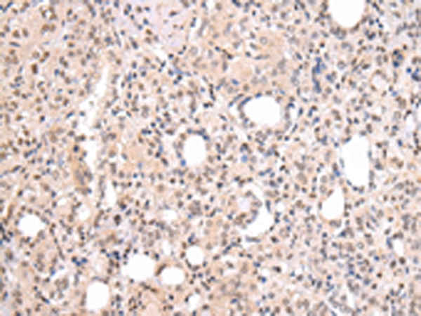 CBX7 Antibody
