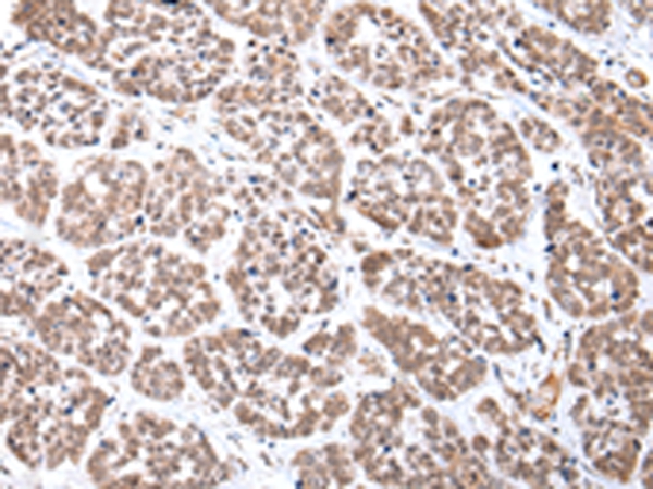 CDX2 Antibody