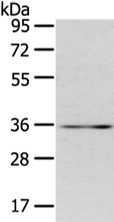 CDX2 Antibody