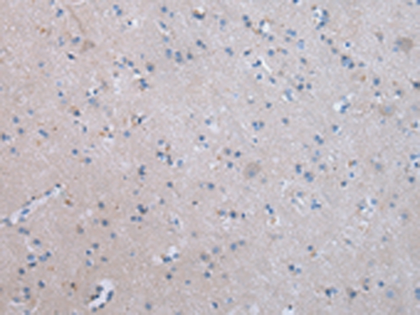 COLEC12 Antibody