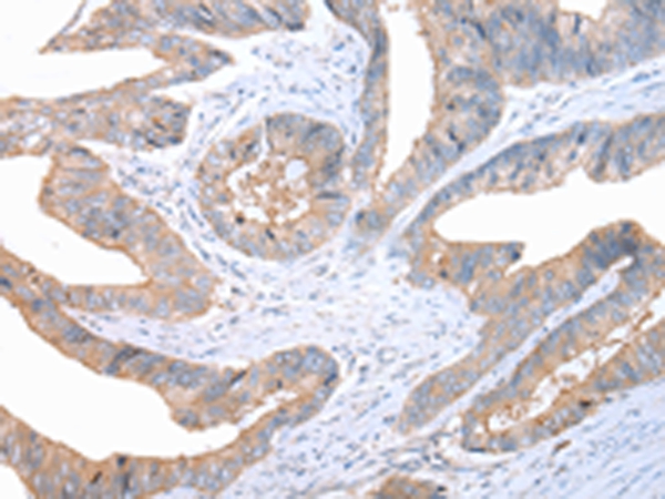 FASN Antibody