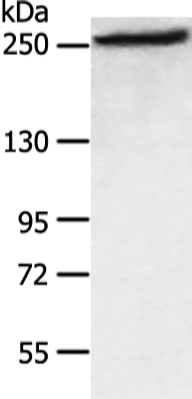 FASN Antibody