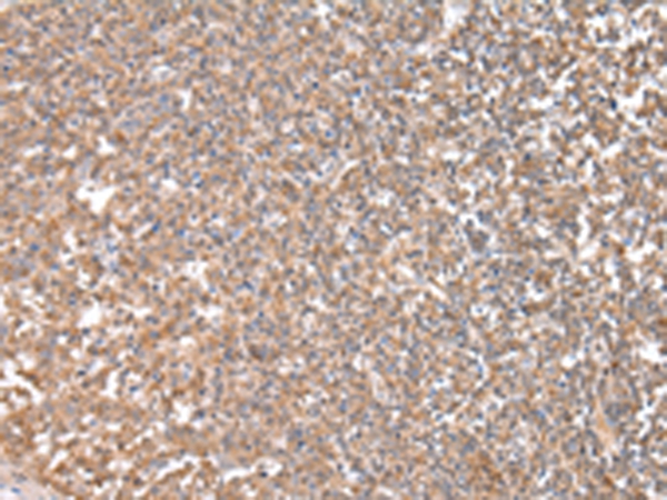 CPT1C Antibody