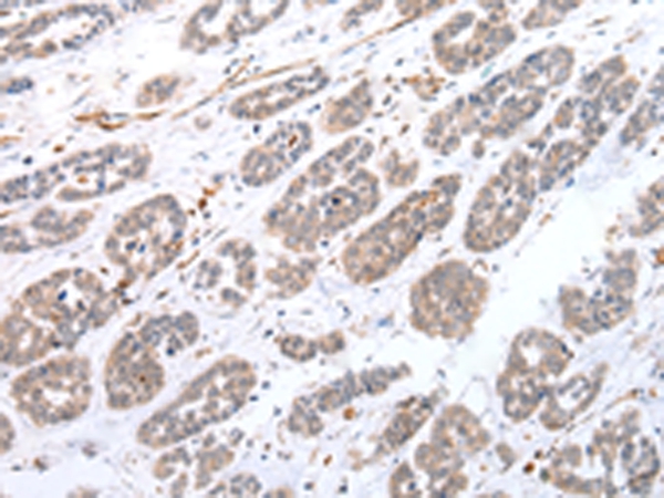 CPT1C Antibody