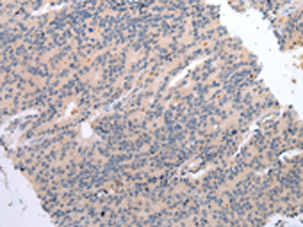 DVL3 Antibody