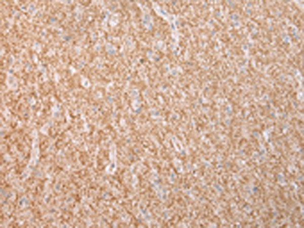 DYSF Antibody