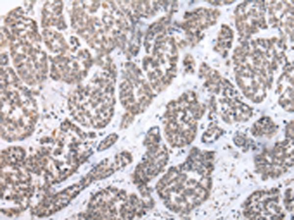 PTGER3 Antibody