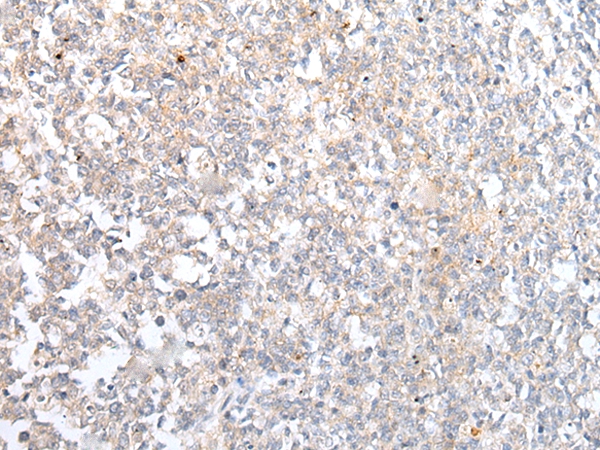 ABCB10 Antibody