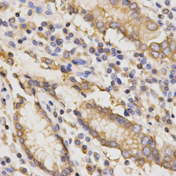TAPBP Antibody