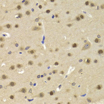 SATB1 Antibody