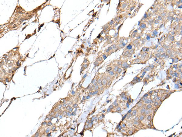 IL20 Antibody