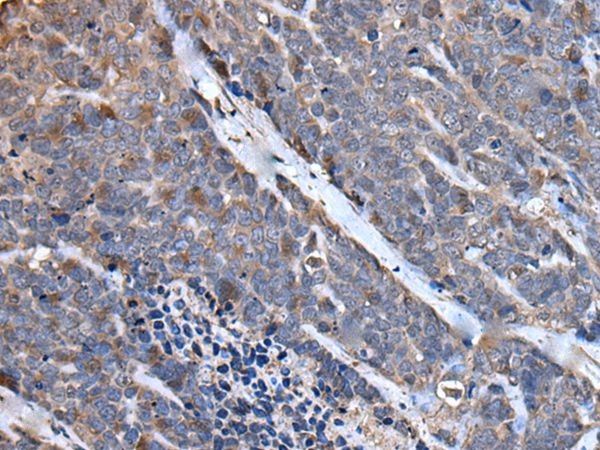 MCM10 Antibody