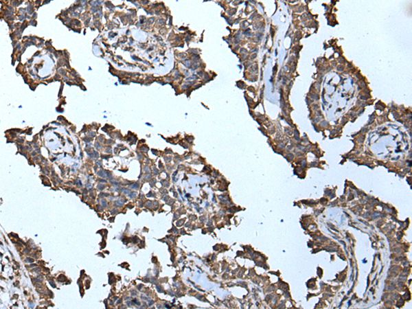 MCM10 Antibody