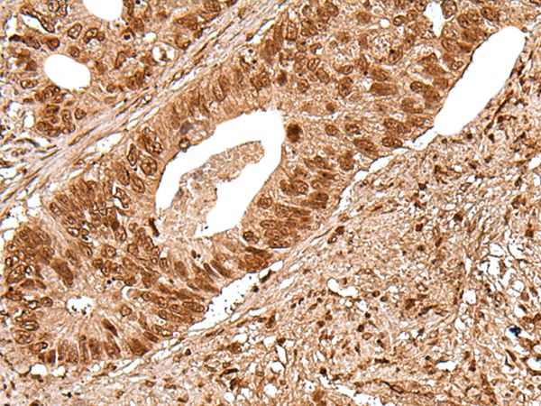 DEDD2 Antibody