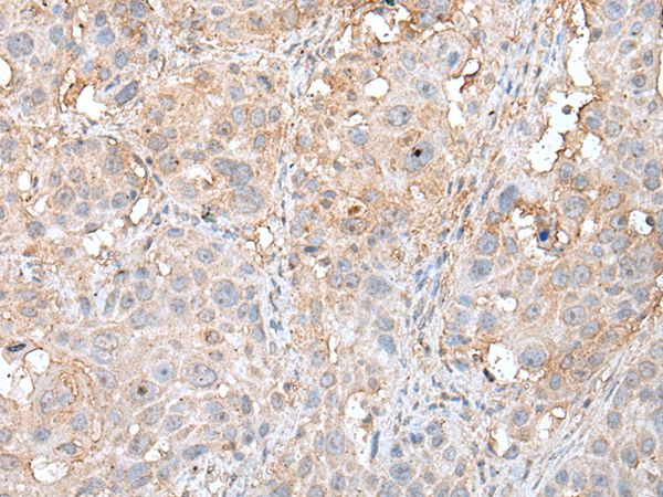 DEDD2 Antibody