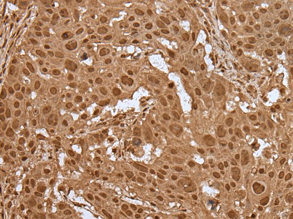 ELF1 Antibody