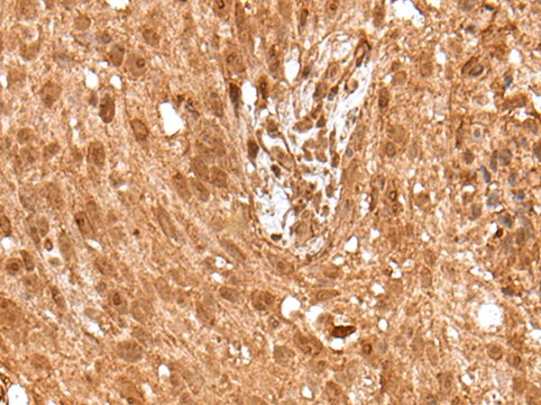 ELF1 Antibody