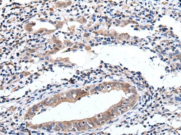 ELMO1 Antibody