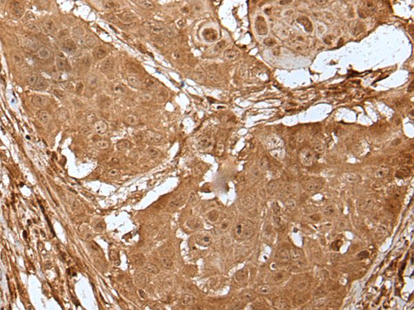 LIPG Antibody