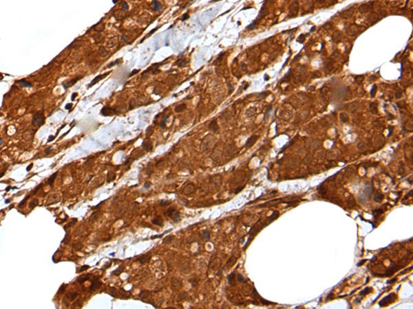 LIPG Antibody