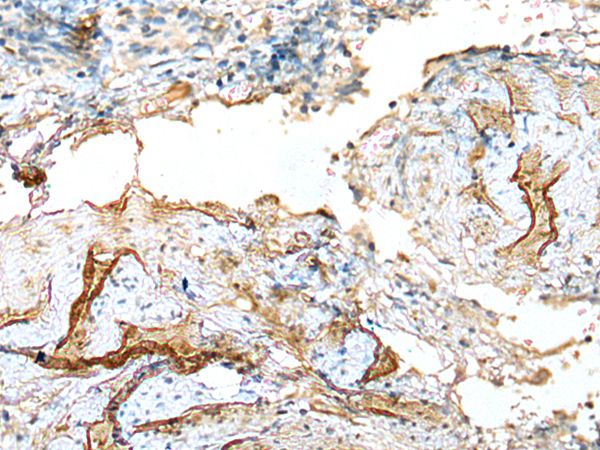 LDHD Antibody