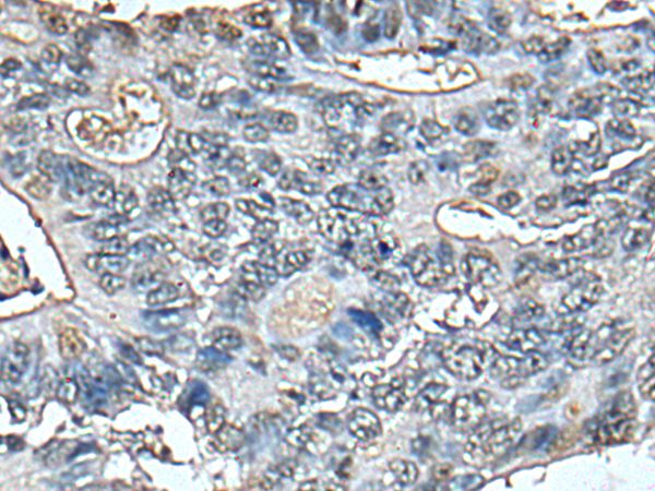 STRADA Antibody