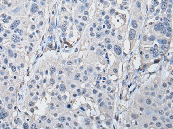 PRKAR2A Antibody