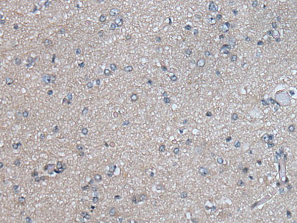 PLK4 Antibody