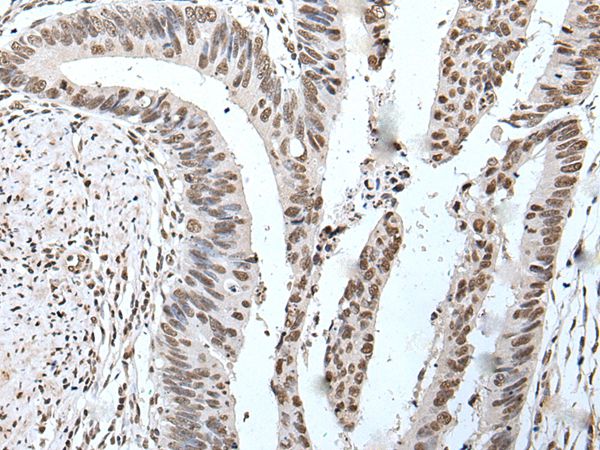 POT1 Antibody