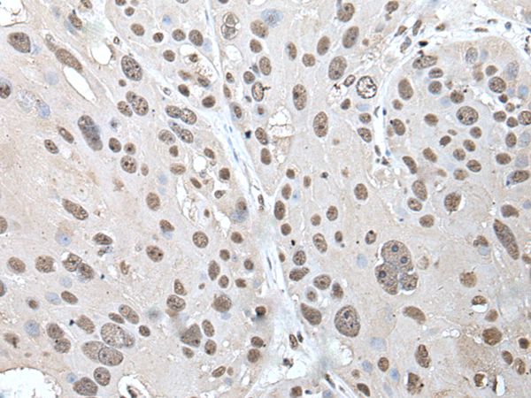 POT1 Antibody