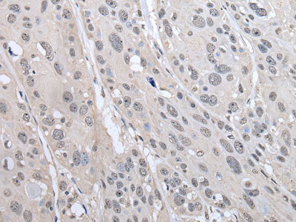 PRAME Antibody