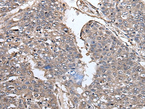 PRUNE Antibody