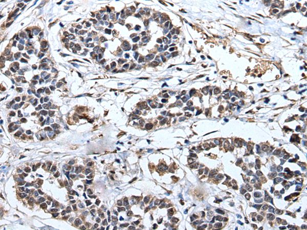 PRUNE Antibody