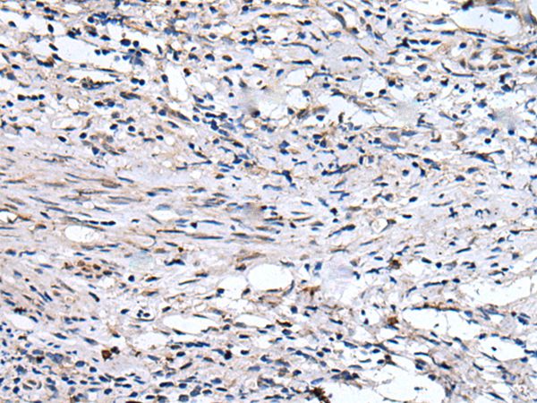 QSOX1 Antibody
