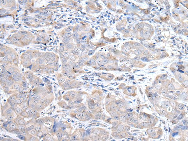 RASA1 Antibody