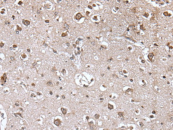 TRIM27 Antibody